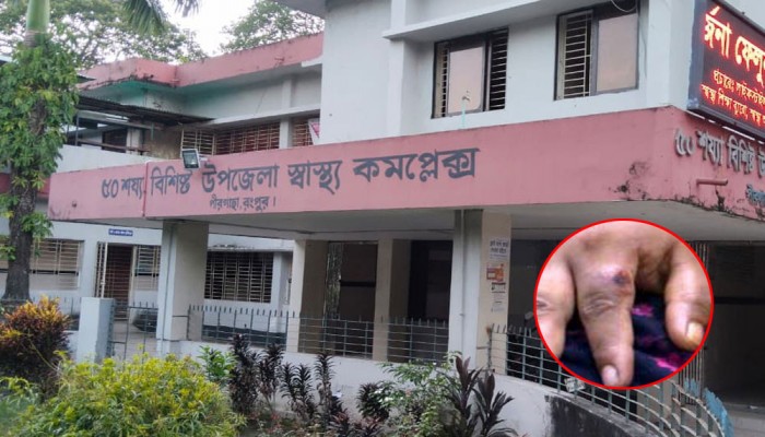 রংপুরের আরো দুই উপজেলায় অ্যানথ্রাক্সের উপসর্গ