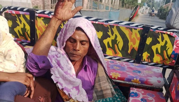 জমি-বাড়ি লিখে না দেওয়ায় বাবাকে রড দিয়ে পিটুনি